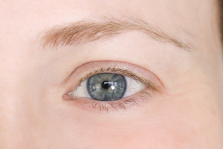 Going Big With Volume Lashes Before & After